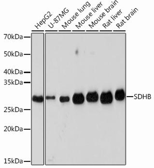 Anti-SDHB Antibody (CAB1809)