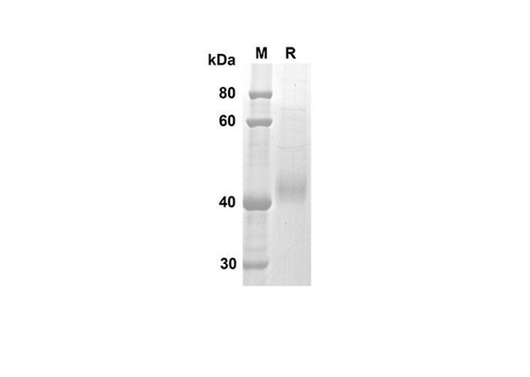 Recombinant Mouse CTSB Protein (His Tag) (RPES8427)