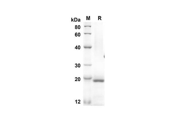 Recombinant Mouse ESM1 Protein (His Tag) (RPES8440)