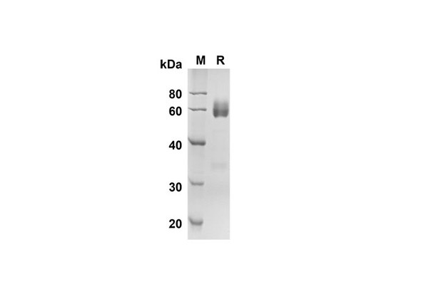 Recombinant Mouse Angptl4 Protein ( Fc Tag) (RPES8455)