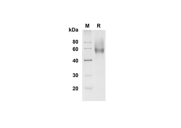Recombinant Mouse L-Selectin/CD62L Protein (His Tag) (RPES8465)