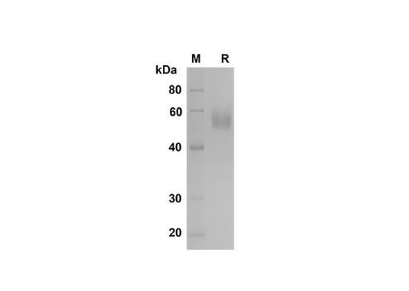 Recombinant Mouse Fas/TNFRSF6/CD95 Protein (Fc Tag) (RPES8485)