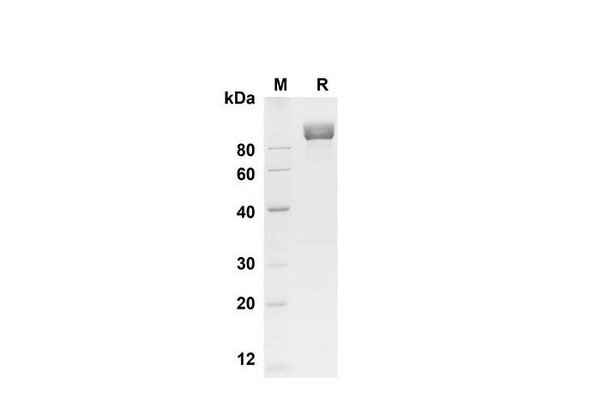 Recombinant Mouse CD117/c-kit Protein (Fc Tag) (RPES8487)