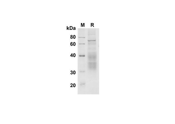 Recombinant Mouse Clusterin Protein (His Tag) (RPES8491)
