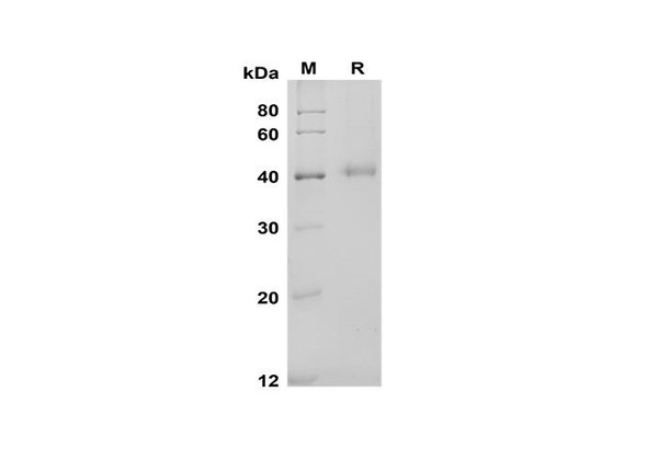 Recombinant Mouse IL-17 RB Protein (His Tag) (RPES8499)