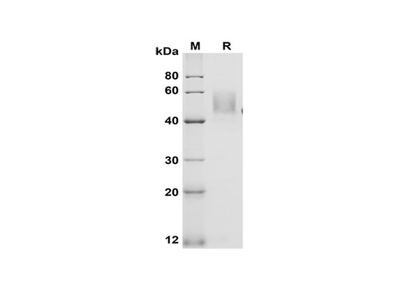Recombinant Mouse GITR/TNFRSF18 Protein (Fc Tag) (RPES8506)