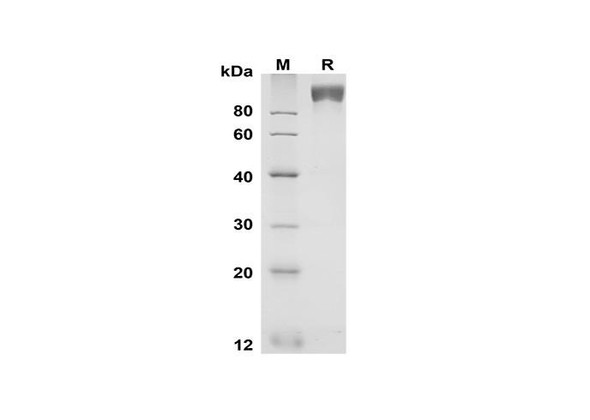Recombinant Mouse gp130 Protein (Fc Tag) (RPES8507)