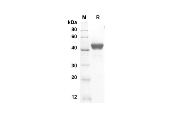 Recombinant Rat GM-CSF Protein (Fc Tag) (RPES8518)