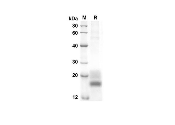 Recombinant Rat GM-CSF Protein (His Tag) (RPES8527)