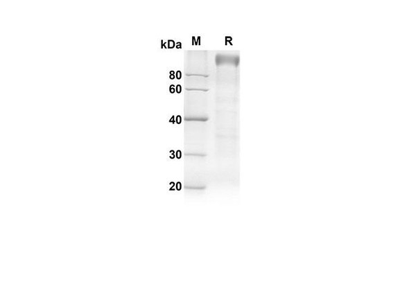 Recombinant Rat TLR4 Protein (Fc Tag) (RPES8529)