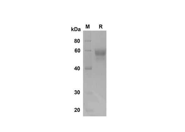 Recombinant Rat 4-1BB/TNFRSF9/CD137 Protein (Fc Tag) (RPES8535)