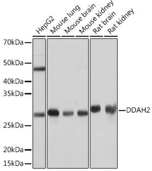 Anti-DDAH2 Antibody (CAB4159)