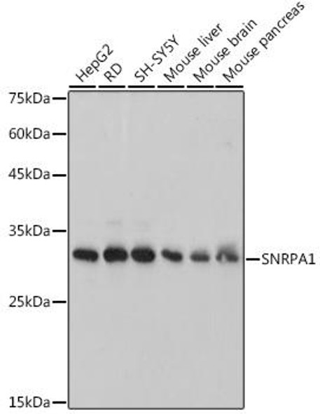 Anti-SNRPA1 Antibody (CAB0647)