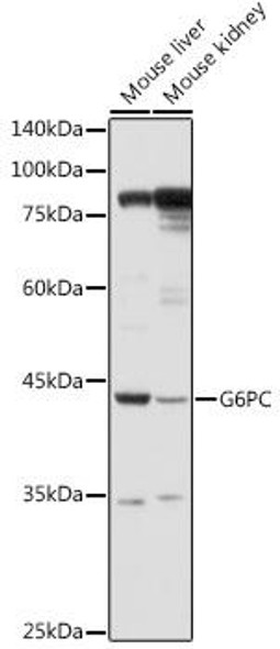 Anti-G6PC Antibody (CAB20193)