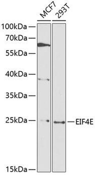 Anti-EIF4E Antibody (CAB0468)