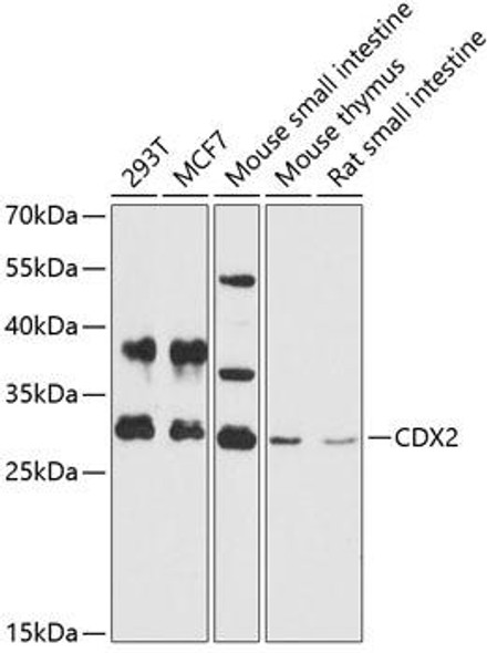 Anti-CDX2 Antibody (CAB0804)