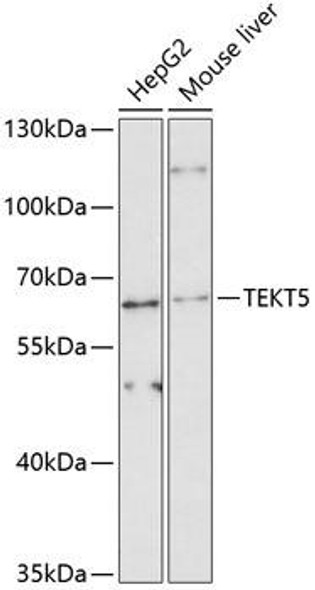 Anti-TEKT5 Antibody (CAB12378)