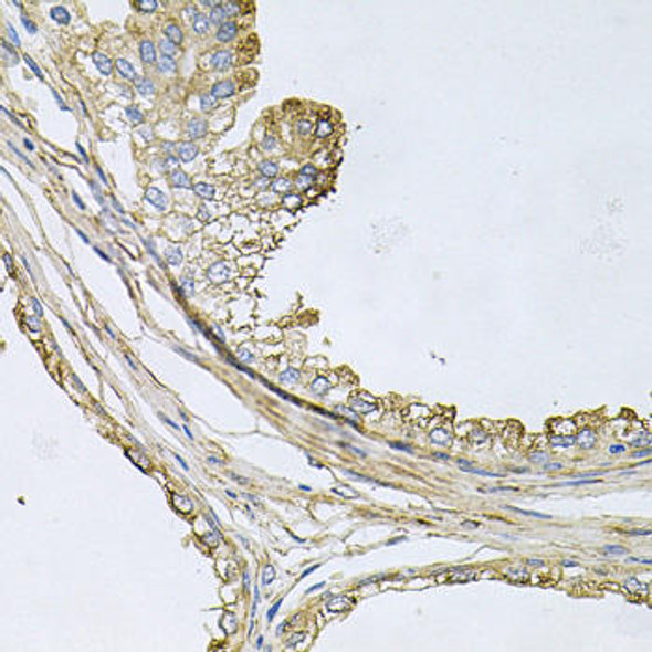 Anti-ApoE Antibody (CAB12400)