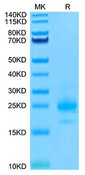 Biotinylated Recombinant Human TNFRSF10A/DR4/TRAIL-R1/CD261 Protein (RPCB0022)