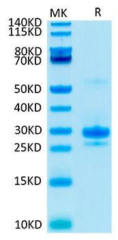 Biotinylated Recombinant Human VEGF-A/VEGF165 Protein (RPCB0027)