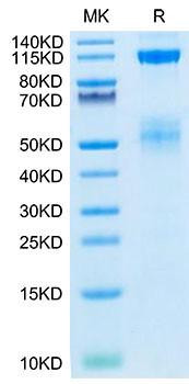 Biotinylated Recombinant Human IGF1R/CD221 Protein (RPCB0032)