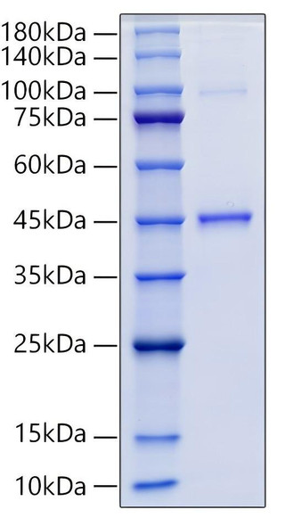 Recombinant Human GDF15 Protein (RPCB0036)