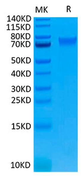 Biotinylated Recombinant Human IL-6RA/CD126 Protein (RPCB0040)
