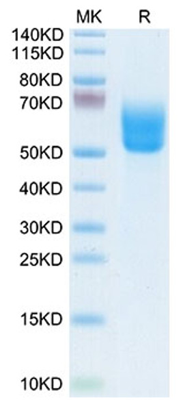 Biotinylated Recombinant Human Dkk-3 Protein (RPCB0045)
