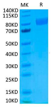Biotinylated Recombinant Human IL-17RA/CD217 Protein (RPCB0052)