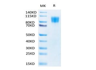 Biotinylated Recombinant Human PDGFR-beta/CD140b Protein (RPCB0063)