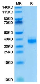 Biotinylated Recombinant Human Ep-CAM/TROP-1/CD326 Protein (RPCB0066)