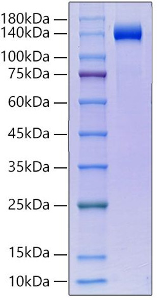 Recombinant Human Klotho beta/KLB Protein (RPCB0090)