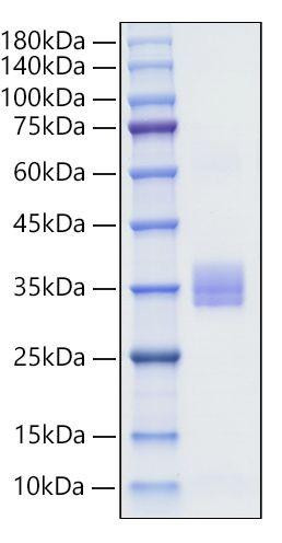 Recombinant Human IgA1  Protein (RPCB0128)