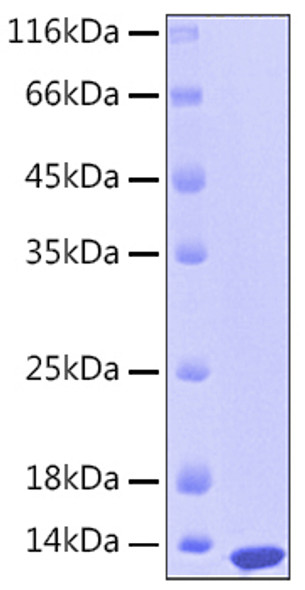 Recombinant Human S100-A12 Protein (RPCB0158)