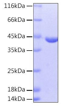 Recombinant Human cAspAT/AATC/GOT1 Protein (RPCB0169)