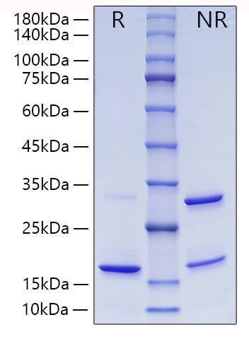 Recombinant Human ISG15 Protein (RPCB0183)