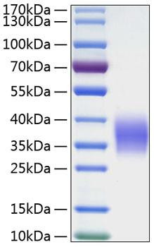 Recombinant Human Ephrin-B2/EFNB2 Protein (RPCB0186)