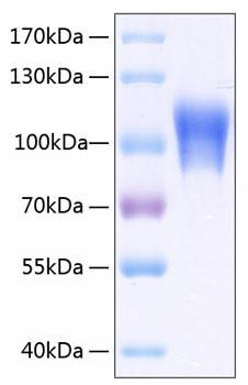 Recombinant Human MCAM/CD146 Protein (RPCB0207)