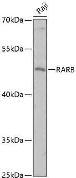 Anti-RARB Antibody (CAB13173)