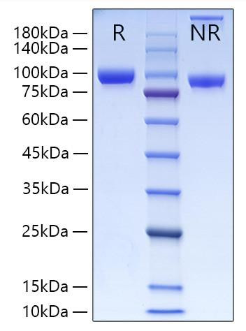 Recombinant Human MMP-9 Protein (RPCB0239)