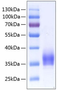 Recombinant Human IL-2RA/CD25 Protein (RPCB0250)