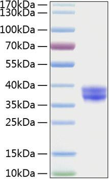 Recombinant Human Cell surface A33 antigen/GPA33 Protein (RPCB0262)
