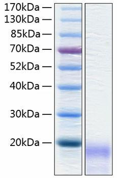Recombinant Human CEACAM3/CD66d Protein (RPCB0267)