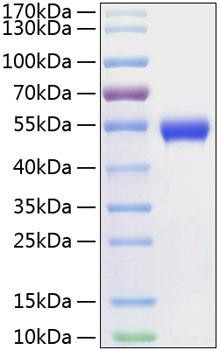 Recombinant Human CD5 Protein (RPCB0274)
