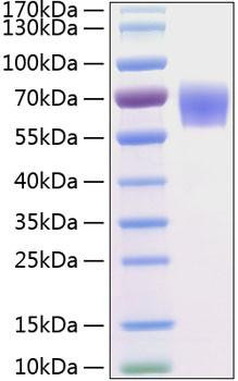 Recombinant Human BACE-1/ASP2 Protein (RPCB0277)