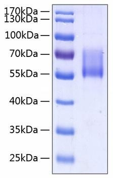 Recombinant Human MUC-1/CD227 Protein (RPCB0295)