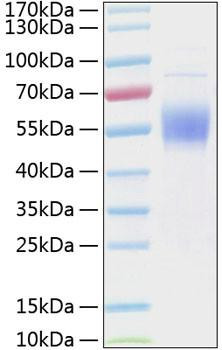 Recombinant Human IL-3RA/CD123 Protein (RPCB0298)