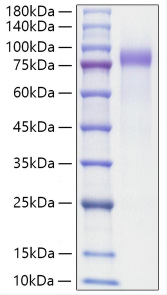 Recombinant Human Progranulin/PGRN/GRN Protein (RPCB0305)