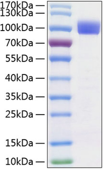 Recombinant Human TYRO3 Protein (RPCB0312)