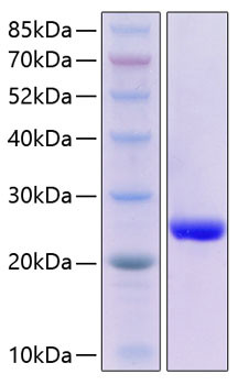 Recombinant Human Serum Amyloid P/SAP Protein (RPCB0327)